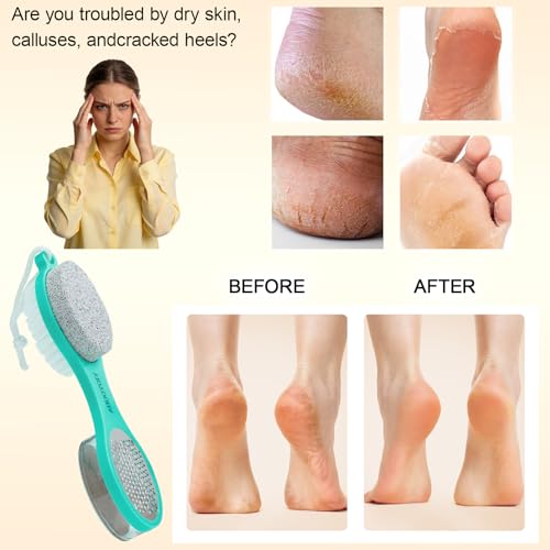 Foot Scrubber Brush with Pumice Stone for Feet 5-in-1, 2Pcs Foot File Callus Remover, Stainless Steel Feet Scraper, Cleaning Brush & Sand Paper Debris Catcher, Multi Purpose Home Foot Care, Cyan White - color: Cyan White