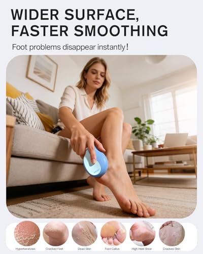 BEZOX Glass Foot File Callus Remover – Professional Foot Scrubber for Dead Skin & Cracked Heels – Premium Pedicure Tools for Feet with Anti-Slip Handle and Protective Cover - Blue - color: Blue