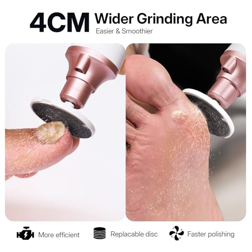 Litbear Thick Toenail Grinder, 15X Professional Electric Nail Drill File Set, Cordless Pedicure Manicure Tool Callus Remover for Women Men Senior Hand Feet Care, Home Salon Use ( White ) - size: White