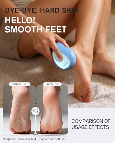 BEZOX Glass Foot File Callus Remover – Professional Foot Scrubber for Dead Skin & Cracked Heels – Premium Pedicure Tools for Feet with Anti-Slip Handle and Protective Cover - Blue - color: Blue