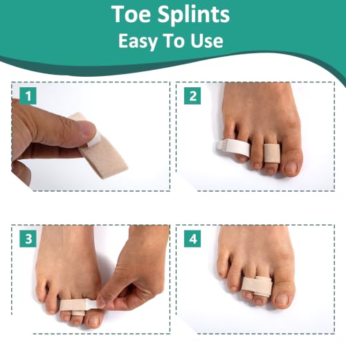 10 Pack Hammer Toe Straightener, Hammertoe Corrector for Women Men, Buddy Tape for Broken Toe, Reusable Toe wrap, Fabric Toe Splints for Bent, Curled, Crooked, Claw, Hammer Toes (5L + 5S, Beige)