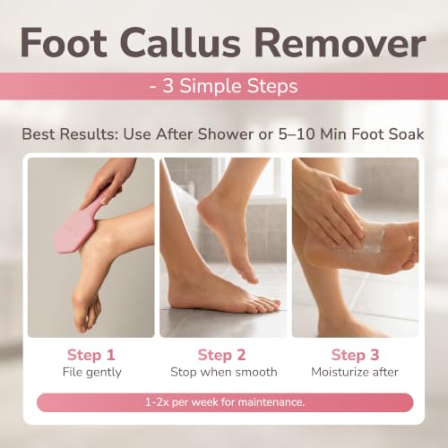 SILKLE Nano Glass Foot File - Foot Callus Remover for Feet & Foot Scrubber - style: Pink