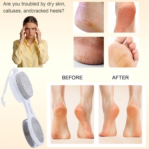 Foot Scrubber Brush with Pumice Stone for Feet 5-in-1, 2Pcs Foot File Callus Remover, Stainless Steel Feet Scraper, Cleaning Brush & Sand Paper Debris Catcher, Multi Purpose Home Foot Care, Pink White - color: Pink White