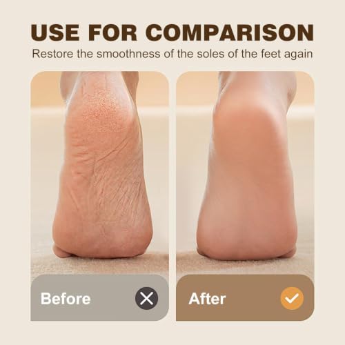 1 Pack Glass Foot File Callus Remover, Pattern D - color: A1-transparent