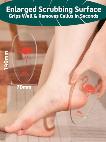 Glass Foot File Callus Remover for Feet, Flamingo Gifts for Women, Feet Scrubber Dead Skin Remover, Professional Pedicure Tools at Home, Heel Scraper for Cracked Heels Heavy Duty - color: Classic-flamingo