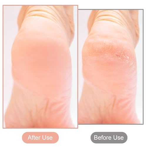 2 Pcs Nano Foot File Glass Nail File Foot Scrubber Callus Remover Rough and Smooth Sides Professional Pedicure Tools at Home Heel Scraper for Dead Skin Removal Cracking Wet and Dry Feet