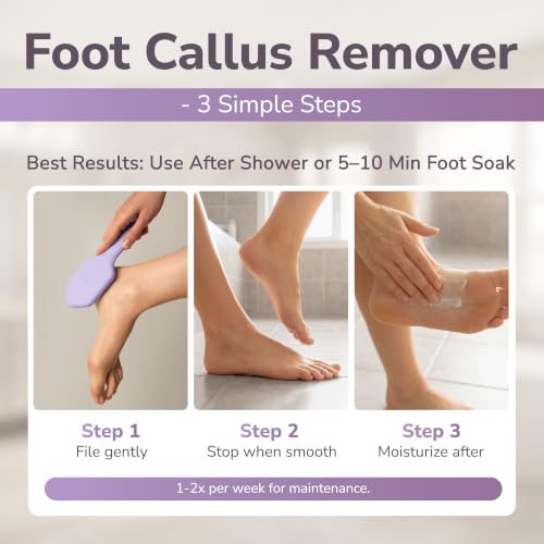 SILKLE Nano Glass Foot File - Foot Callus Remover for Feet & Foot Scrubber - style: Purple