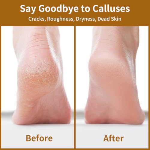 Nano Glass Foot File, Double-Sided Foot Callus Remover for Cracked Heels - color: Black