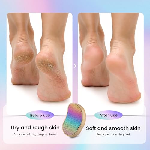 BEZOX Stainless Steel Pedi Egg Foot File Callus Remover for Dry and Wet Feet, Smooth Rough Skin, Plastic-Free Pedicure Tool Pumice Stone, Washable Foot Scrubber for Cracked Heels - Rainbow - style: Rainbow