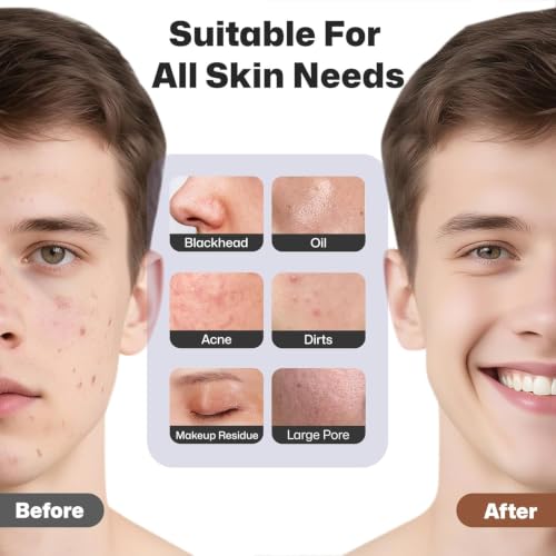 PRITECH Facial Cleansing Brush, Rechargeable Silicone Face Scrubber with Heat Massage End, Vibrating Exfoliator Scrubber for Deep Cleaning, Waterproof Face Brush for Women and Men (Black) - color: Black