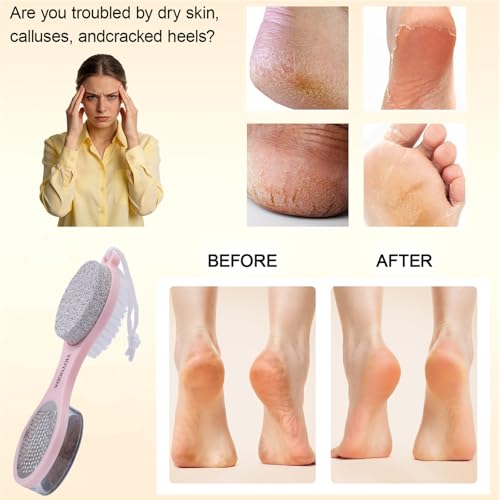 Foot Scrubber Brush with Pumice Stone for Feet Callus Remover Pedicure Tool - color: Pink