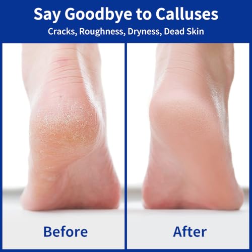 Nano Glass Foot File, Double-Sided Foot Callus Remover for Cracked Heels - color: White