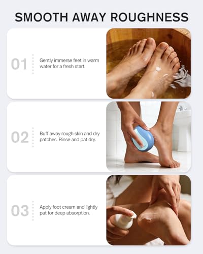 BEZOX Glass Foot File Callus Remover – Professional Foot Scrubber for Dead Skin & Cracked Heels – Premium Pedicure Tools for Feet with Anti-Slip Handle and Protective Cover - Blue - color: Blue