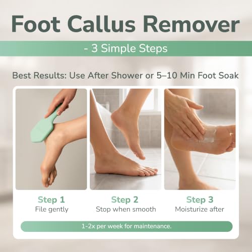 SILKLE Nano Glass Foot File - Foot Callus Remover for Feet & Foot Scrubber - style: Green