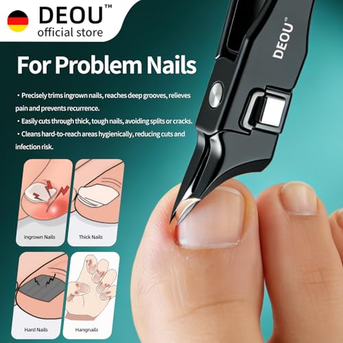 DEOU Ingrown Toenail Clippers with Nail File, Premium Stainless Steel Oblique Cutter, Anti-Splash One-Piece Casting, Manicure Tool with Keyhole, Gift Box for Thick/Hard/Fungal Nails - color: Black Diagonal Scissors