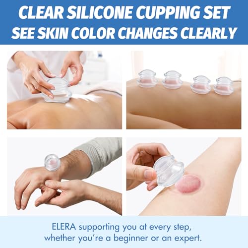 ELERA Silicone Cupping Therapy Set, Professionally Chinese Massage Cups for Cupping Therapy and Cellulite Reduction (7 Cups) - style: 7 Cups (L M S size)