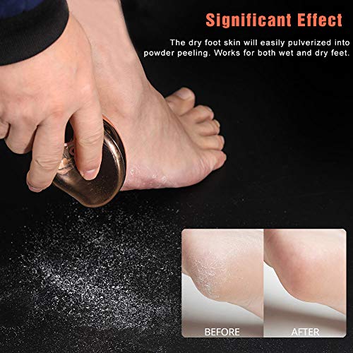 BEZOX Glass Foot File Callus Remover, Crystal Foot Scrubber Pedicure Tool - style: Shinning Golden