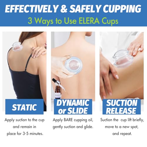 ELERA Silicone Cupping Therapy XL Size Sets, Professionally Chinese Massage Cups Tools, Silicone Cup for Joint Pain Relief, Massage Body (XL*2 Cups) - style: 2 Cups (XL size)