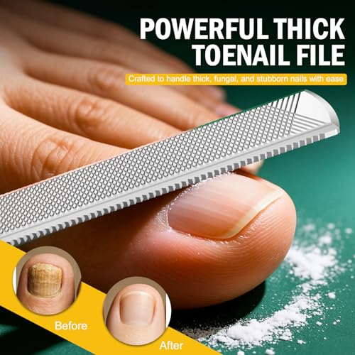 FVION Toenail File for Thick Nails and Toenail Lifter, 2pcs Stainless Steel Nail File and Ingrown Relief Set, Heavy Duty Metal Emery Board for Seniors, Men & Women Pedicure Tool (Green) - color: Green Handle