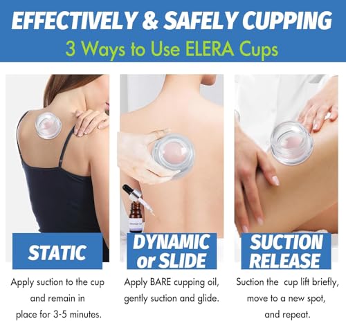 ELERA Silicone Cupping Therapy L Size Sets, Professionally Chinese Massage Cups Tools, Silicone Cup for Joint Pain Relief, Massage Body (L*2 Cups) - style: 2 Cups (L size)