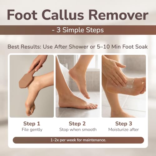 SILKLE Nano Glass Foot File - Foot Callus Remover for Feet & Foot Scrubber - style: Brown